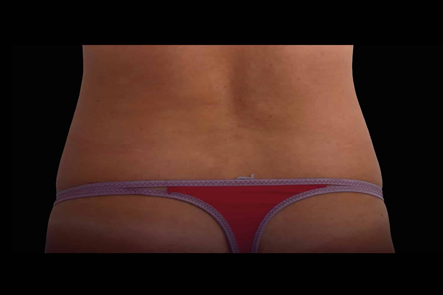 Close up of a woman's hips without love handles after EMSCULPT NEO procedure at Regeneris Medspa