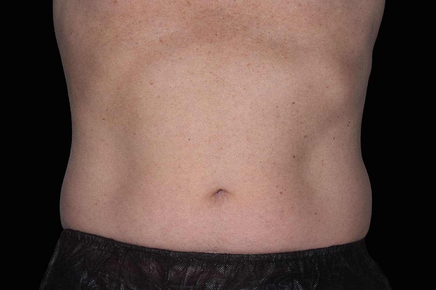 Close up of a man's defined belly after Emsculpt NEO