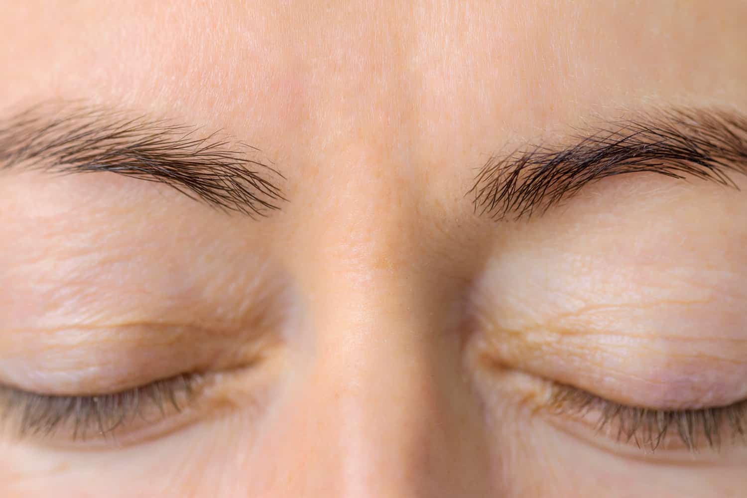 Close up of a woman's forehead and eyes area after Juvederm at Regeneris Medspa without wrinkles