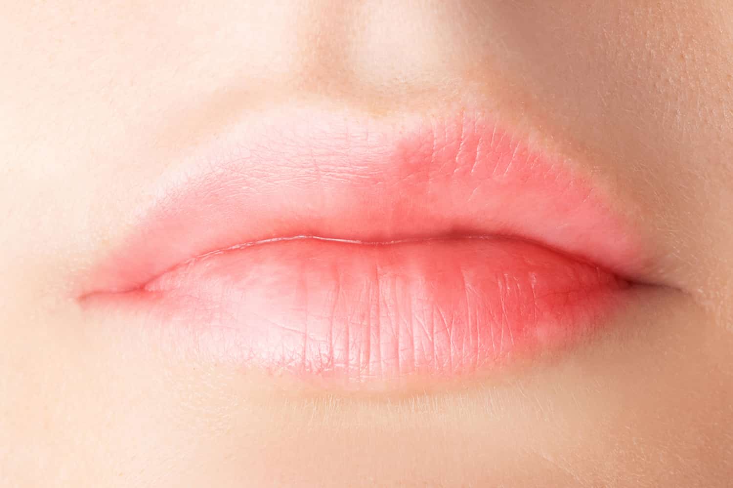 A close up of a lip after to Juvederm procedure looking more plump