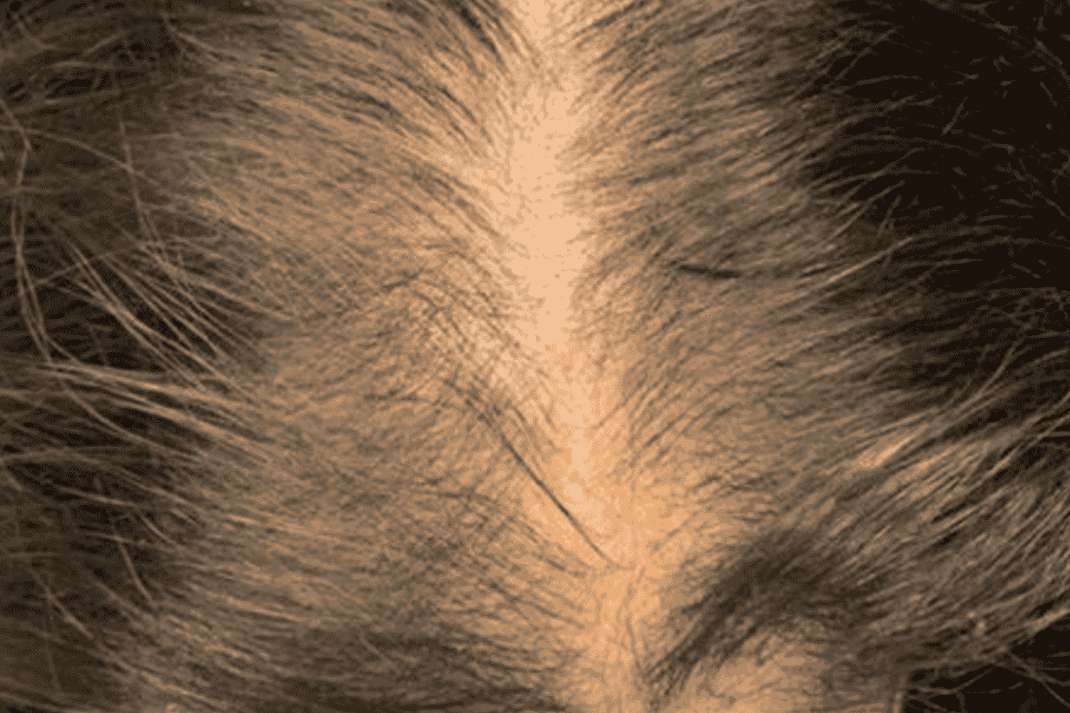 Close up of scalp before Keralase treatment at Regeneris