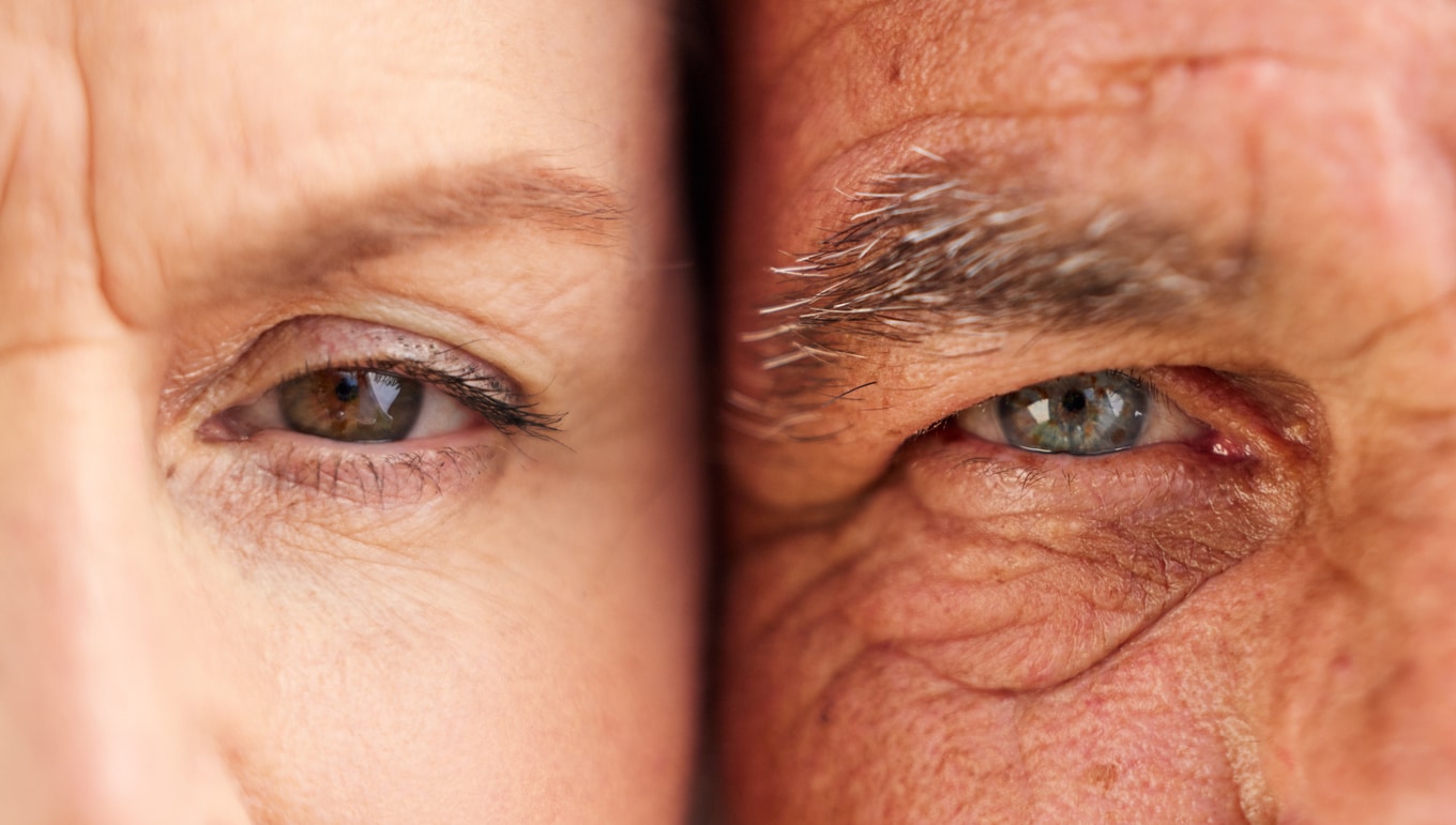 An aging couple, posed cheek to cheek, stare into the camera, demonstrating the wrinkles and effects of aging