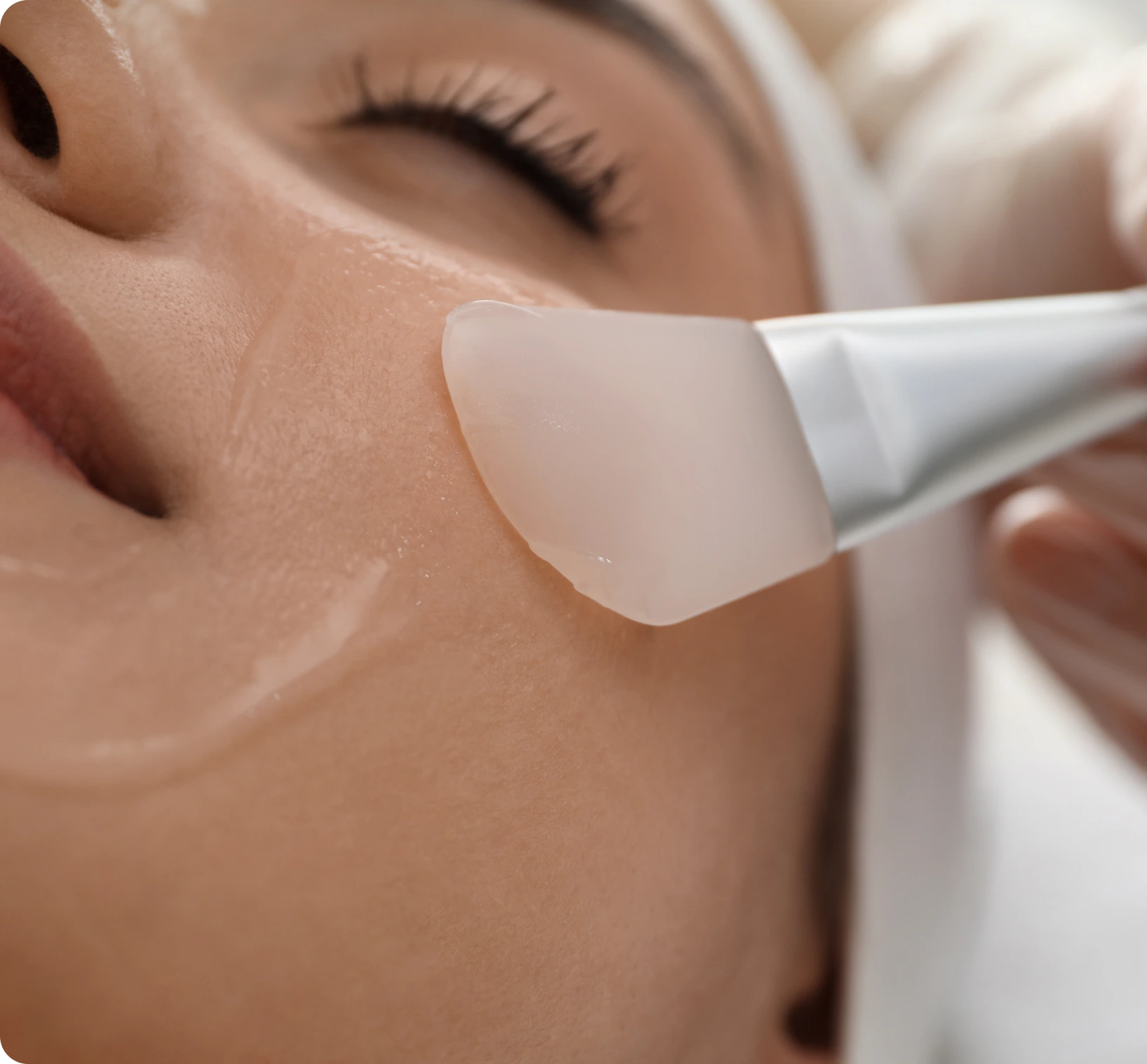 Facial Treatments in South Boston, MA: Chemical Peel Banner