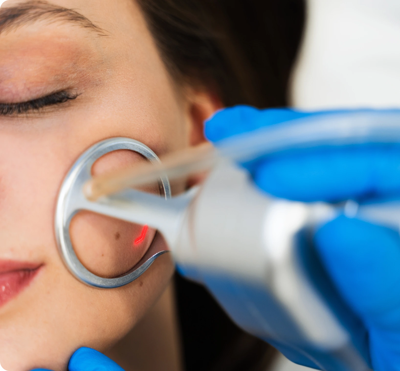 South Boston, MA Face Treatments: LaseMD & Genius RF Banner