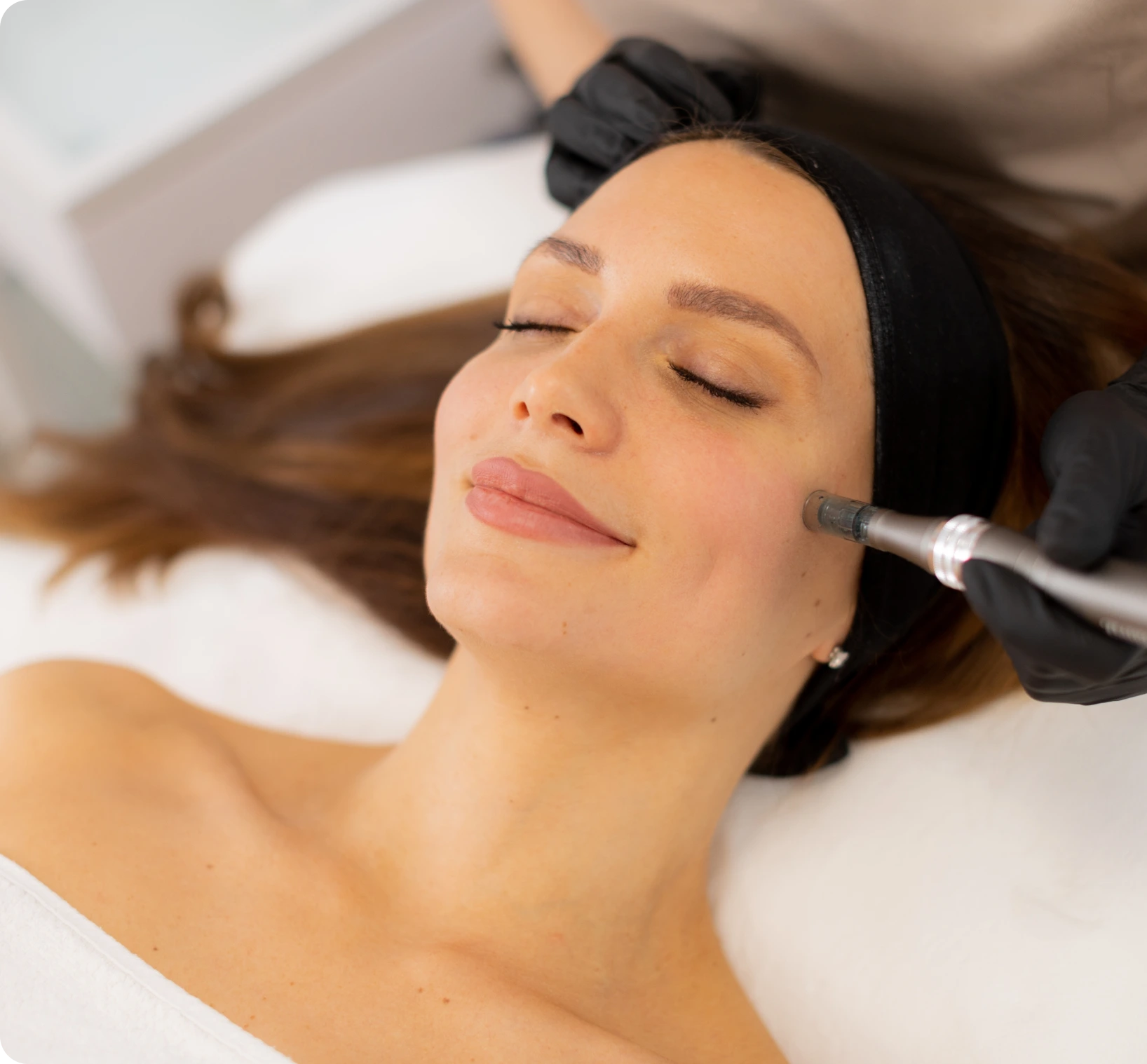 Face Treatments South Boston, MA: Microneedling Banner