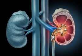 From Breaking Stones to Healing Tissues