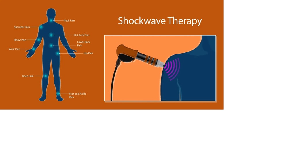 Musculoskeletal Recovery