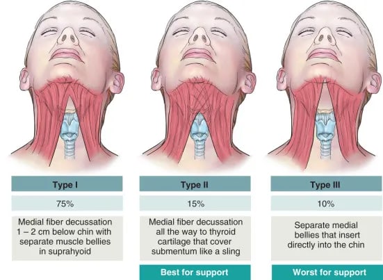 Symptoms of Platysmal Bands